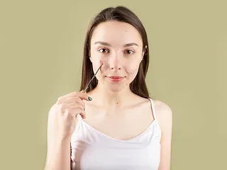 Pigmentvlekken na acne: zo verminder je donkere vlekjes