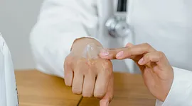 Eucerin AtopiControl review: de beste crème voor eczeem?