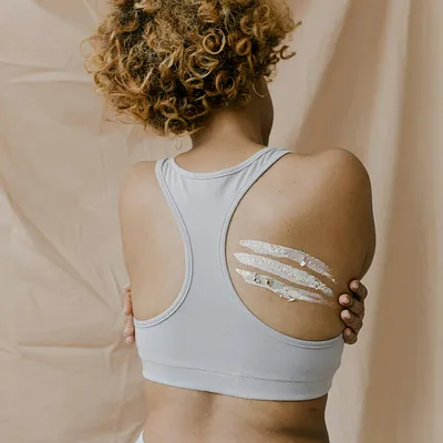 Mee-eters op je rug: oorzaken, verwijderen en voorkomen