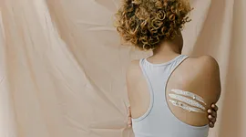 Mee-eters op je rug: oorzaken, verwijderen en voorkomen