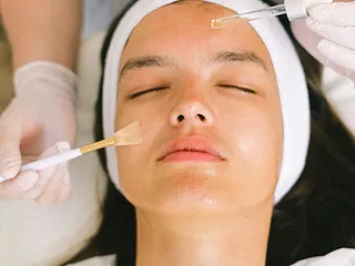 Biodermal Pigmentcrème review