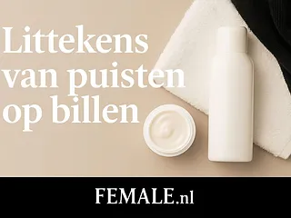 Littekens van puisten op billen